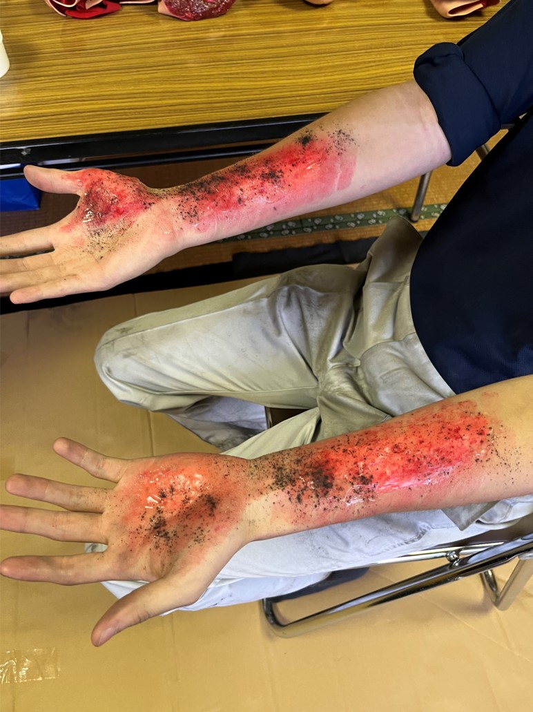 トリアージ訓練キットを用いた防災・避難訓練